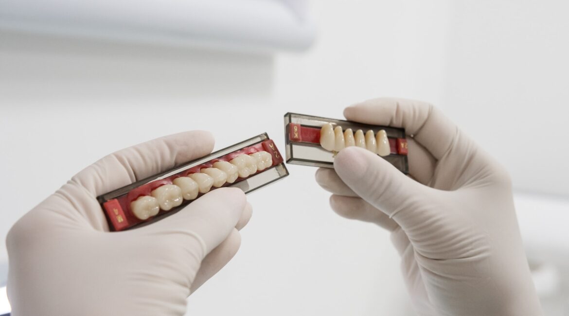 dental crowns