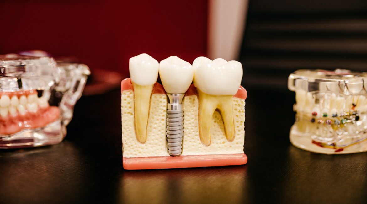 teeth model