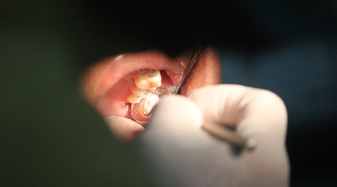 dental problem
