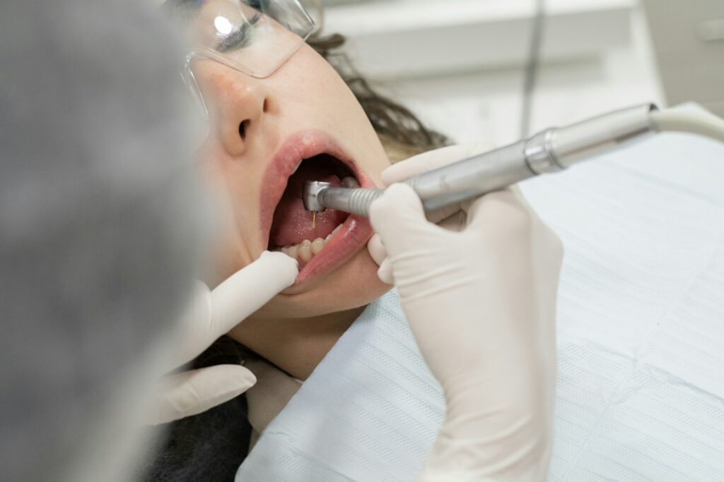 root canal treatment