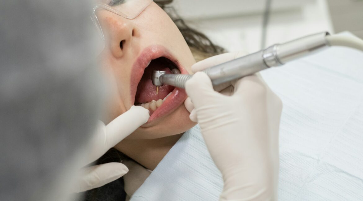 root canal treatment