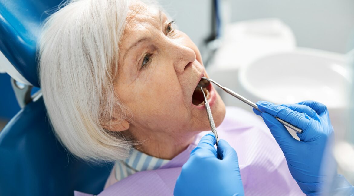 dental implant