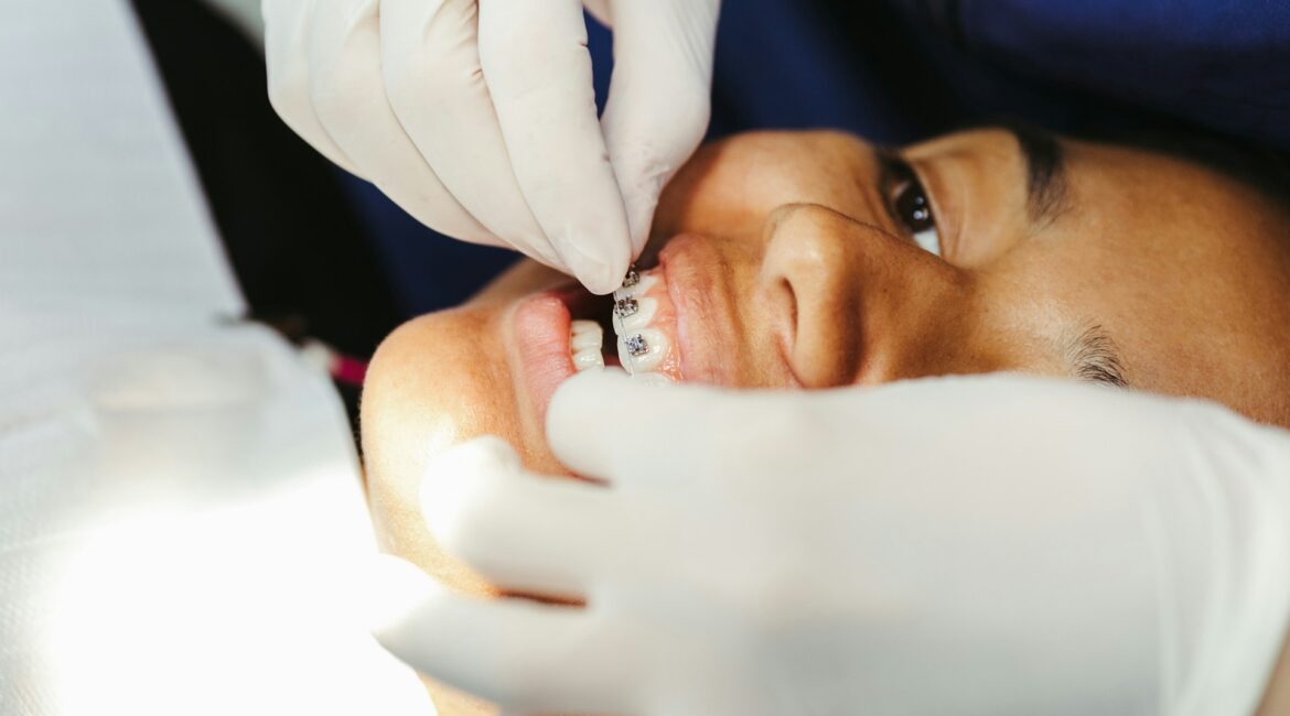 orthodontic treatment