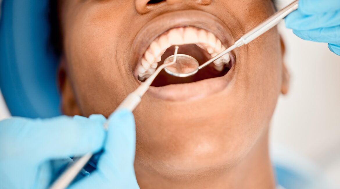 teeth cleaning