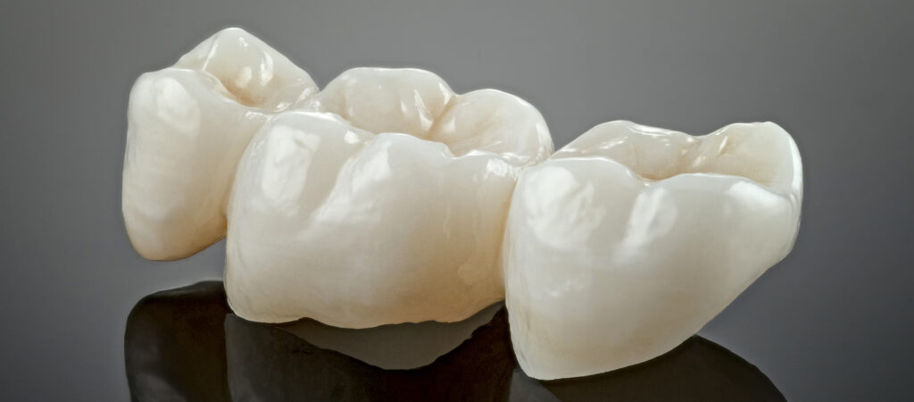 Dental-Crowns