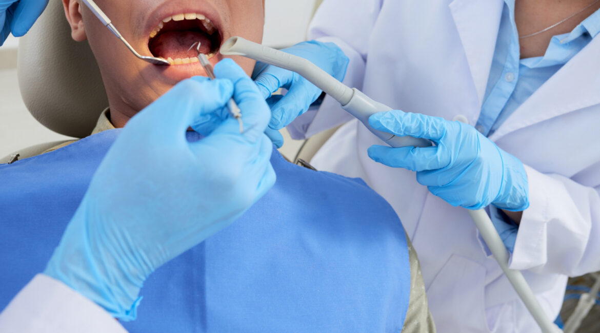 dental implants