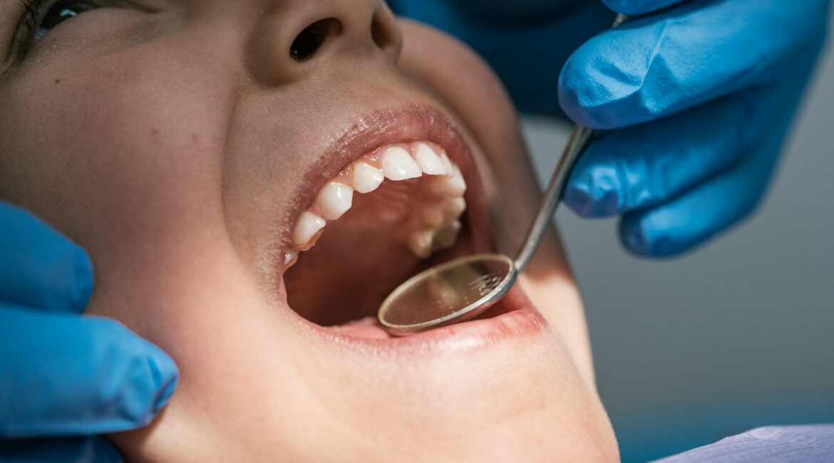 tooth extractions