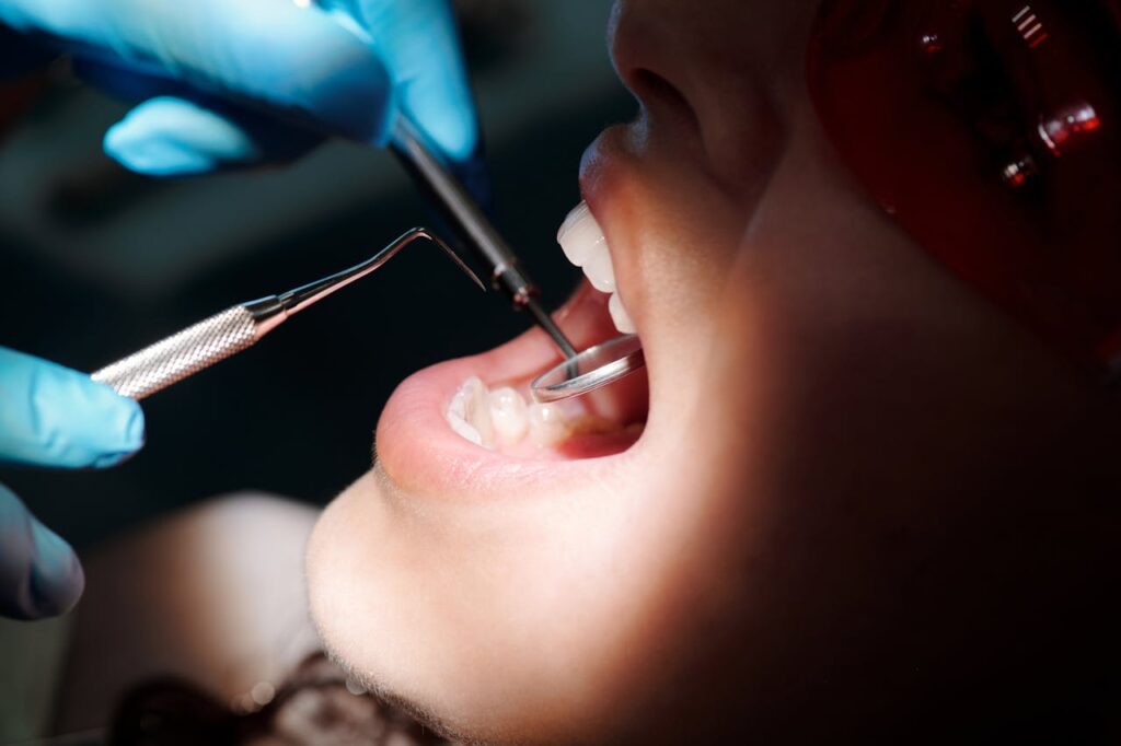 root canal