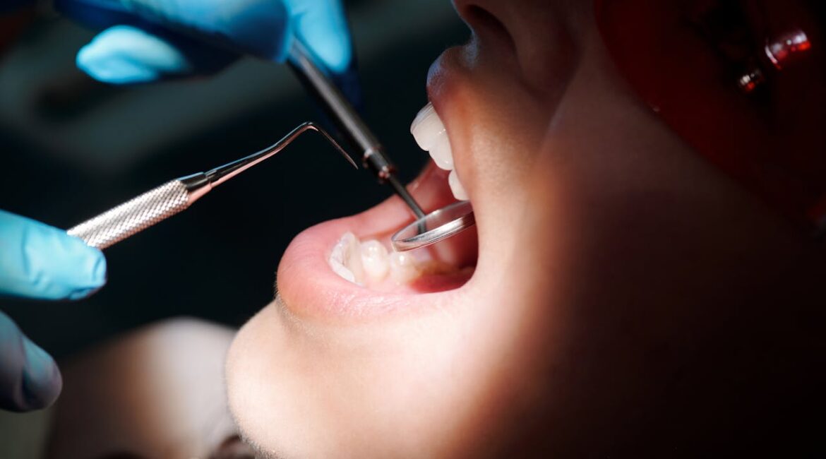 root canal