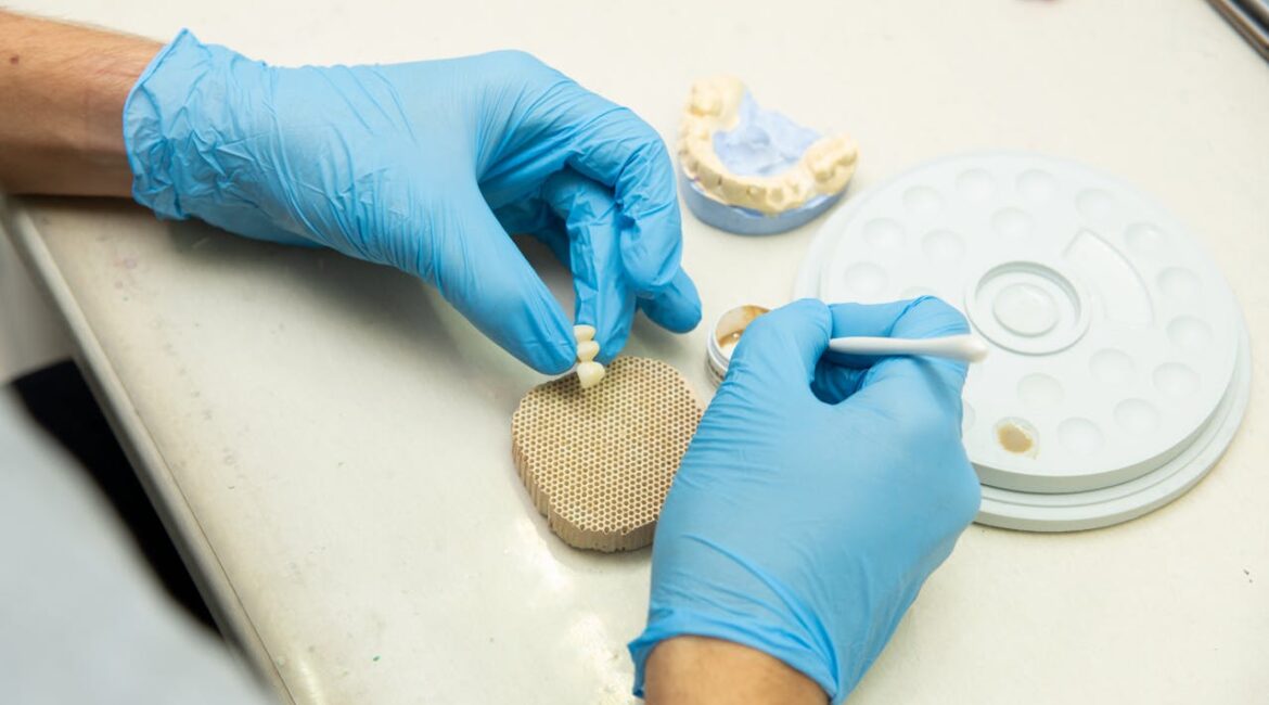 Dental Bridges