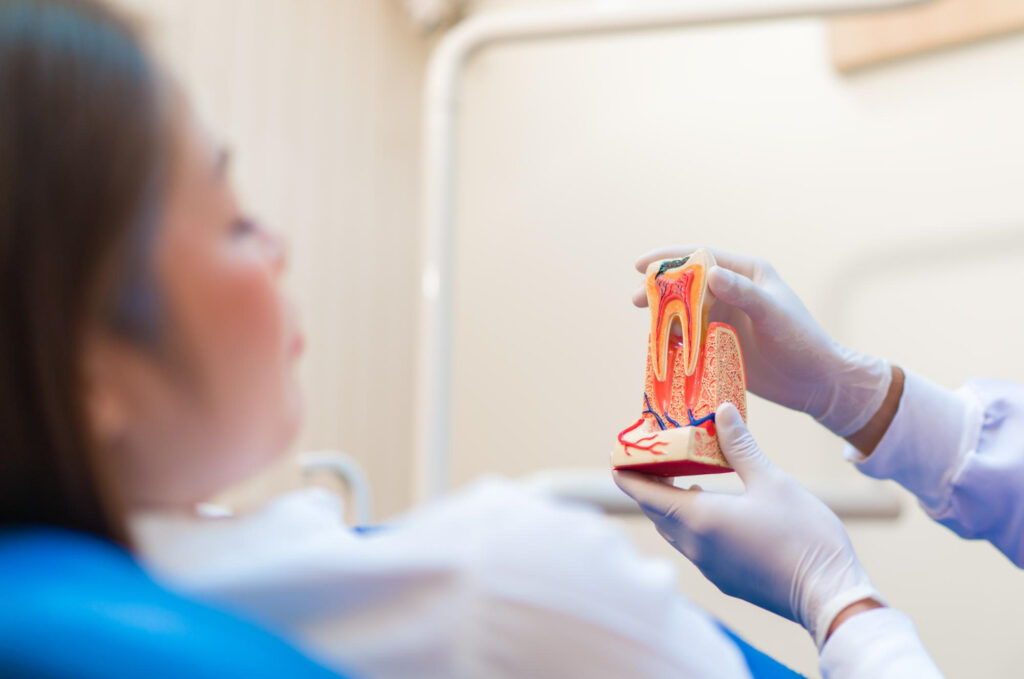 root canal