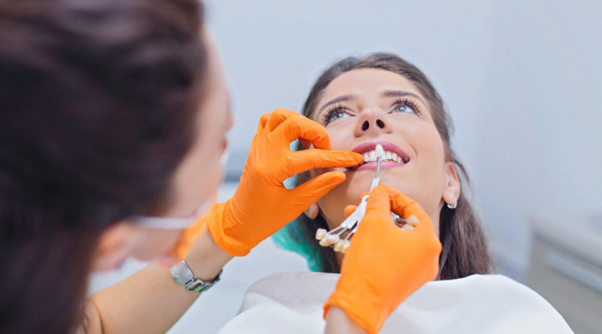 Dentist choosing tooth shade for dental bonding