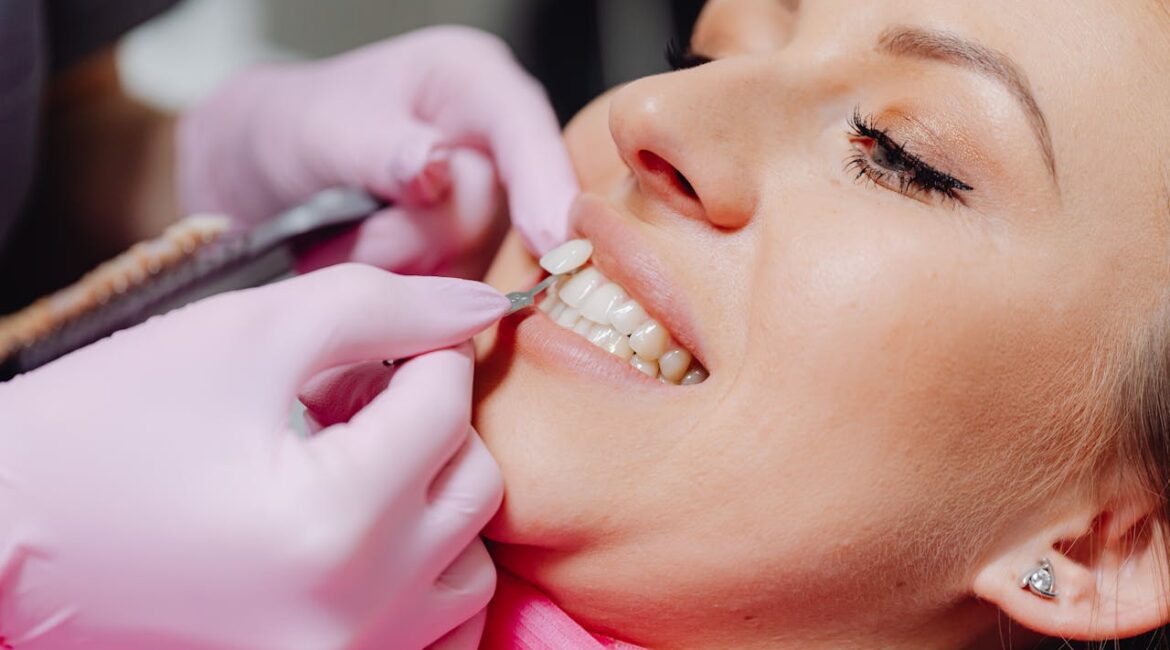 Smile with Veneers