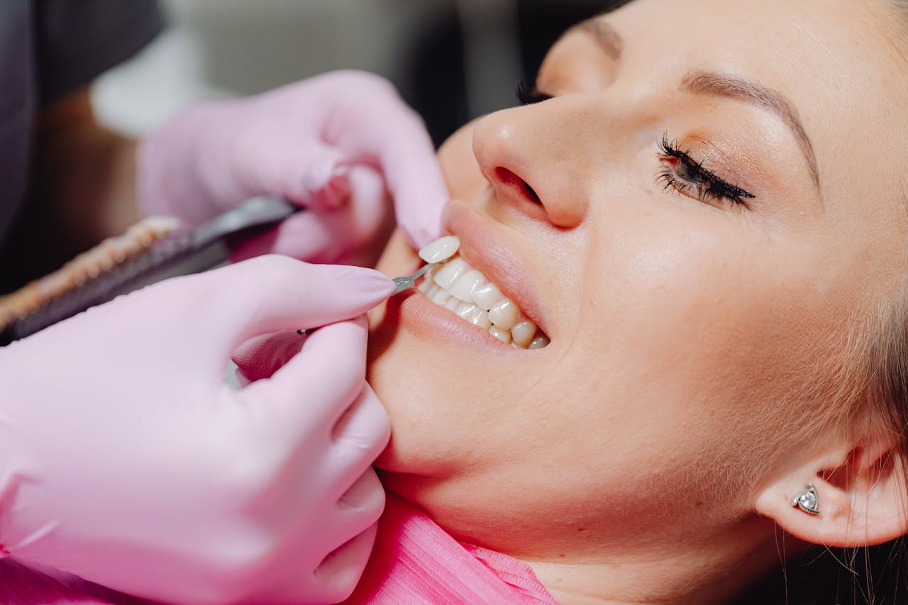Smile with Veneers