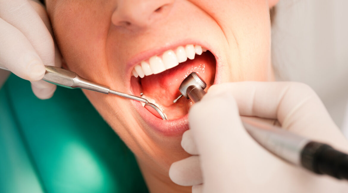 Dental treatment consultation at Ivory Dental