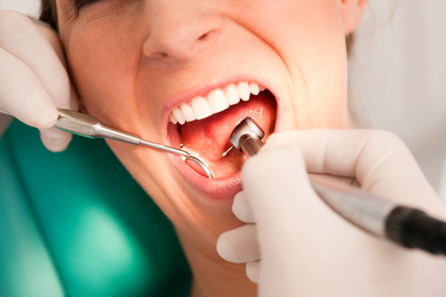 Dental treatment consultation at Ivory Dental