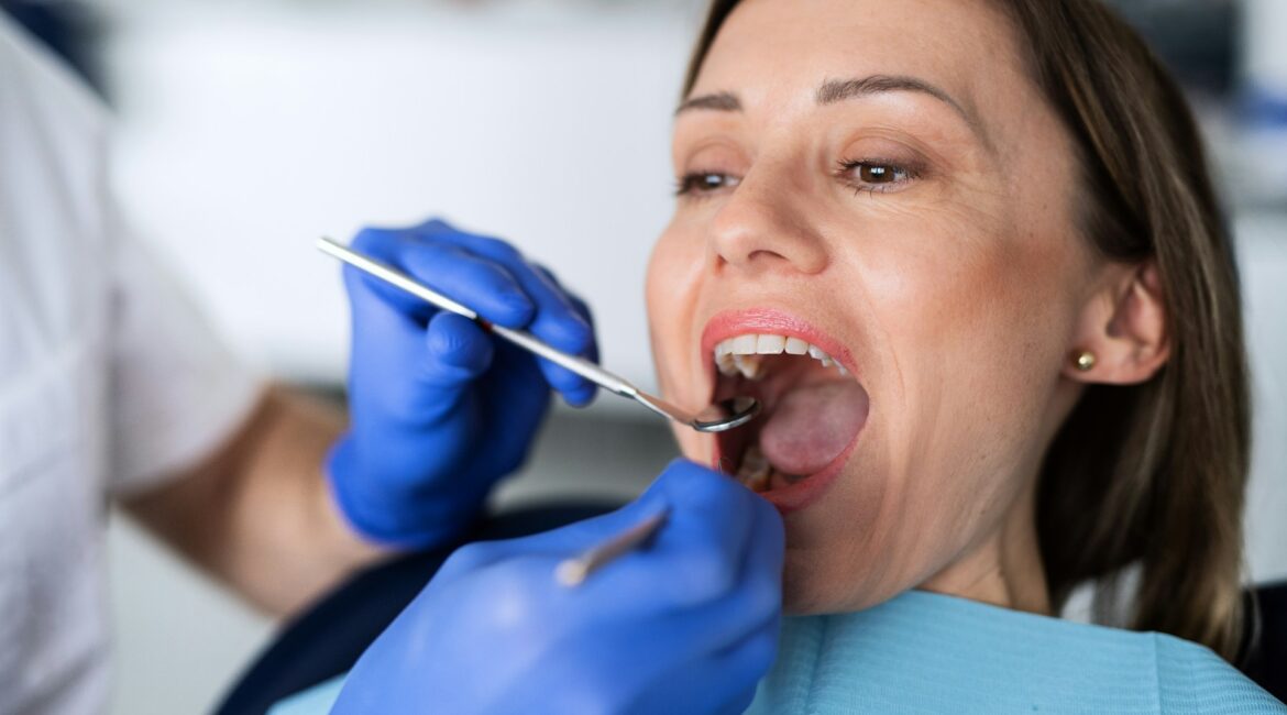dental bridges