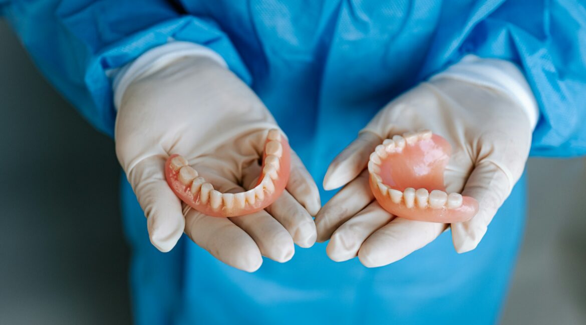 dental implants