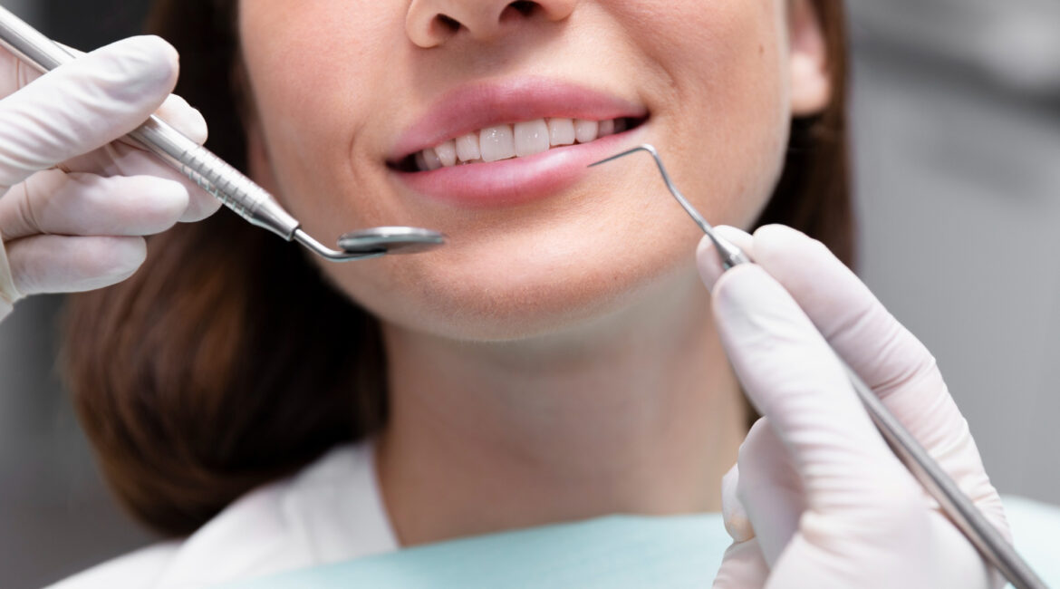 dental implants