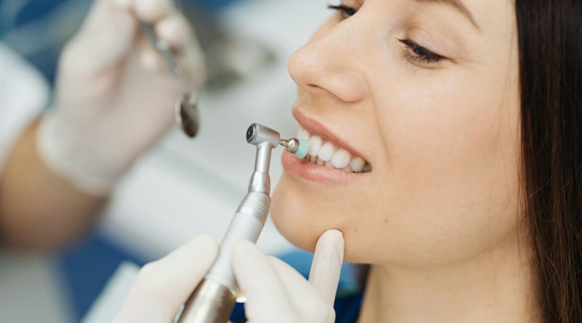 Healthy teeth before cosmetic bonding or veneer planning
